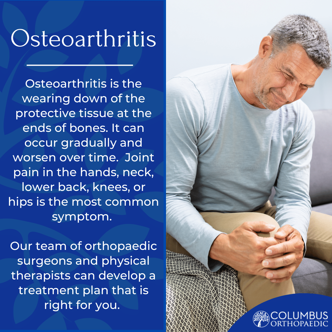 Injury Highlight - Osteoarthritis - Columbus Ortho