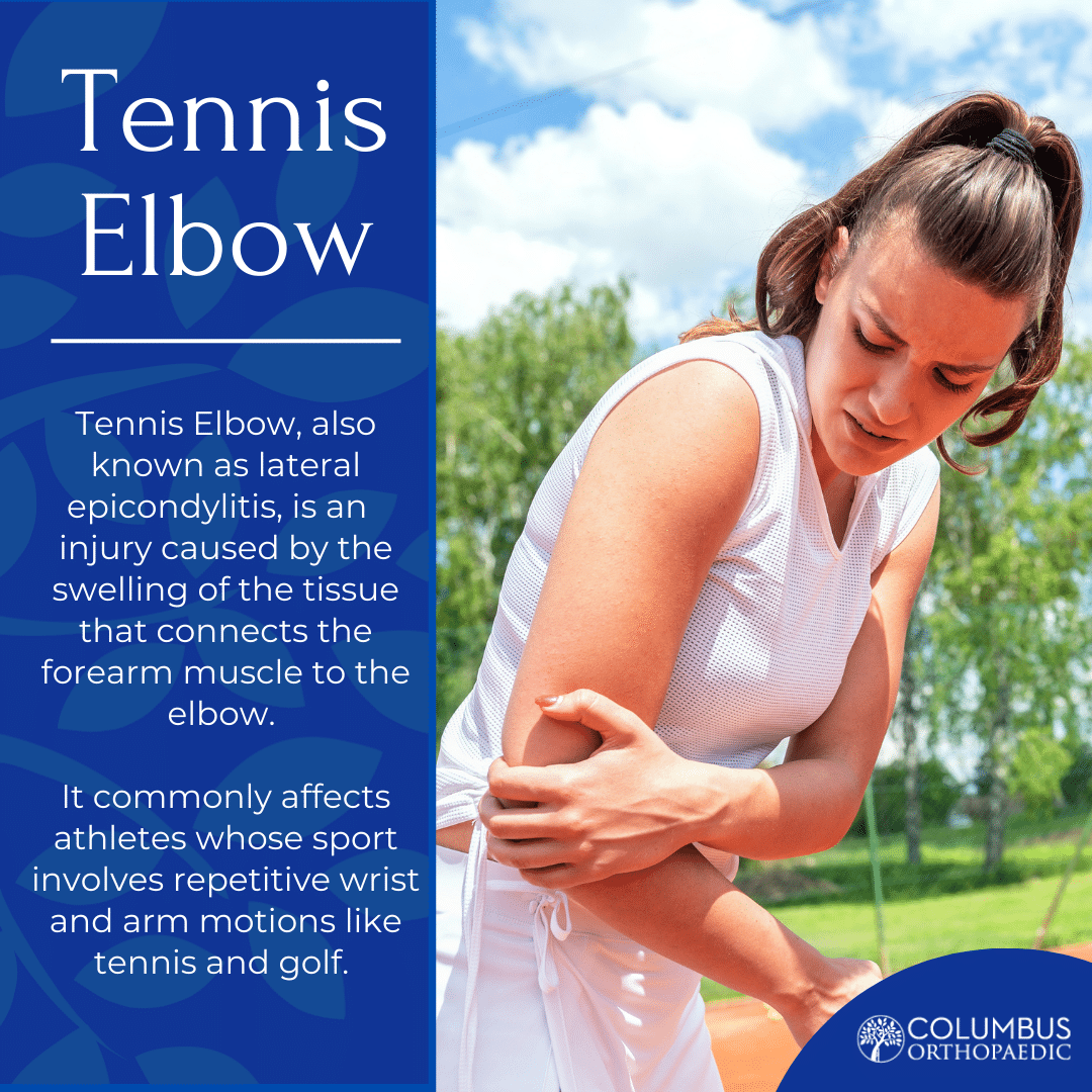 Injury Highlight Tennis Elbow Columbus Ortho